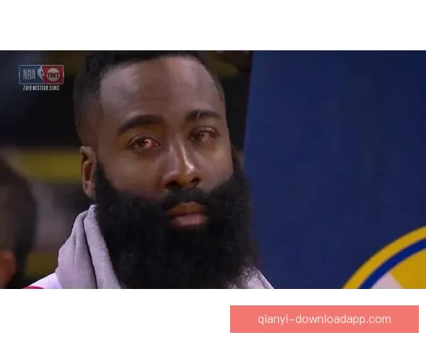 米切尔因眼伤大概率缺席对阵公牛比赛 骑士主帅透露伤情情况